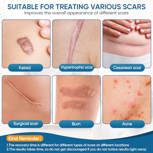 KISEER 2 Rolls Silicone Scar Sheets 1.6 x 60 Inch for Scar & Keloid Removal