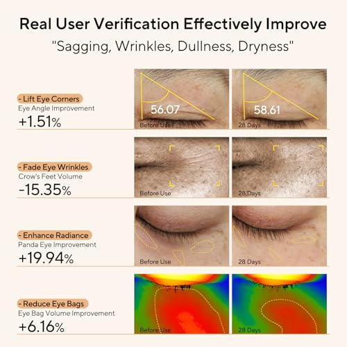 BloomPulse Retinol & Caffeine Eye Serum with Cooling 360° Roller Ball