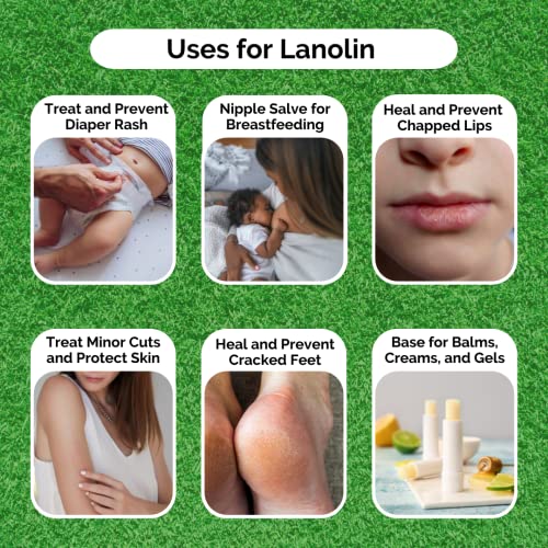SAAQIN 100% Pure Anhydrous Lanolin - Ultra Refined Moisturizer, 4oz
