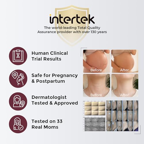 Momcozy Stretch Mark Prevention Cream, Travel Size Belly Moisturizer for Dry Skin, Peptides & Shea Butter, EWG Verified, Dermatologist Tested Maternity Care, 1.06 oz (30g)