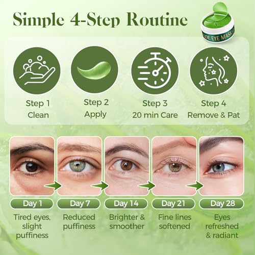 Nexkayee Aloe Vera Under Eye Patches for Dark Circles & Puffiness