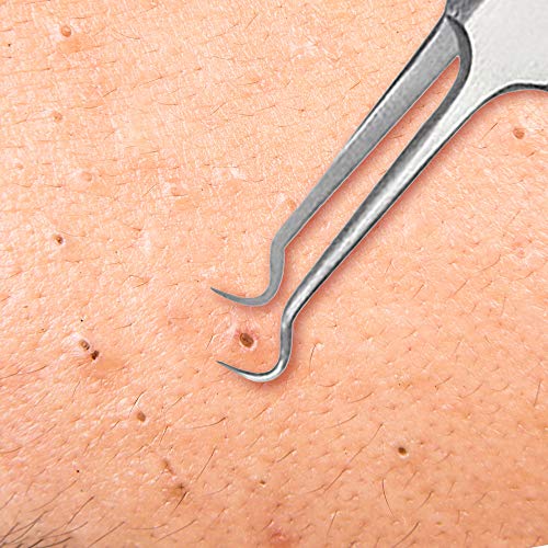 Beaute Galleria Stainless Steel Curved Blemish Extractor Tool