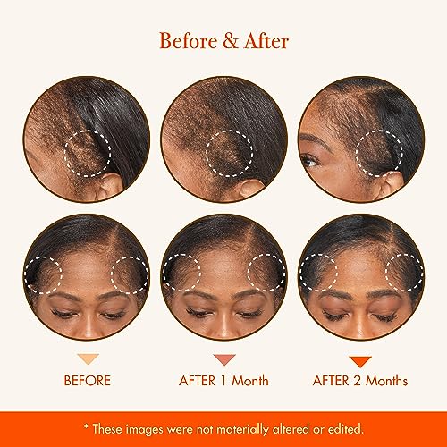 Red by Kiss Growth MD Hair & Scalp Oil 4.5 fl oz | Nourishing Organic Hair Treatment
