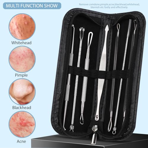 Teenitor 7-in-1 Pimple Popper Tool Kit - Blackhead & Acne Remover