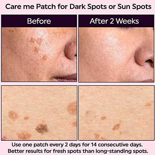 Microdart Dark Spot Patch - 9 Count Acne Treatment for Clearer Skin