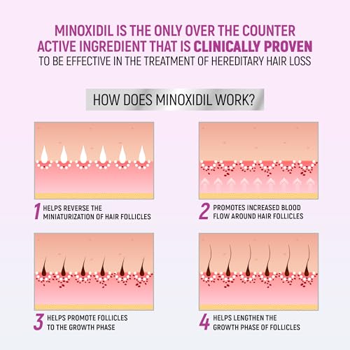 Minoxidil for Women, 2.11 Oz (2 Months Supply) Clinically Proven to Regrow Hair, Topical Aerosol Foam 5%, Hair Thinning Treatment