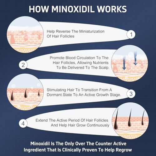 5% Minoxidil Foam with Biotin for Hair & Beard Growth - 4.22oz
