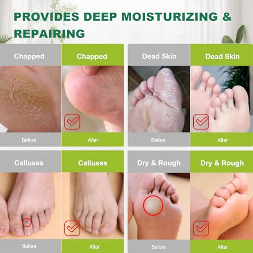 300PCS Extra-Large Disposable Foot Covers for Moisturizing & Spa Care