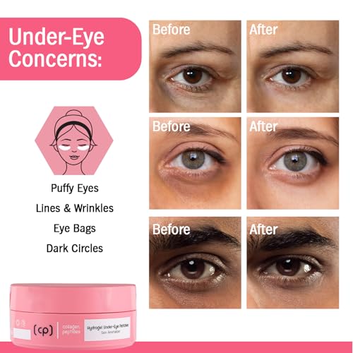 Skincyclopedia Collagen & Peptide Hydrogel Under Eye Patches - 60 Pcs
