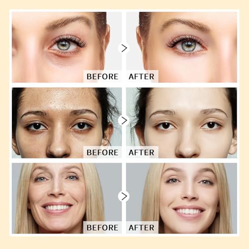 KIUORET 3-Piece Anti-Aging Face Serum Set: Caffeine, Niacinamide & Hyaluronic