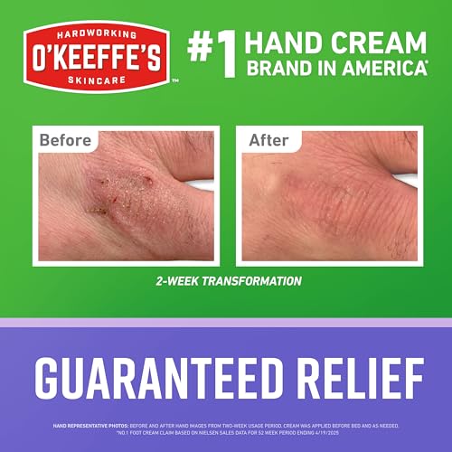 O'Keeffe's Working Hands Night Treatment Hand Cream, 7 oz | Repair Dry Cracked Hands