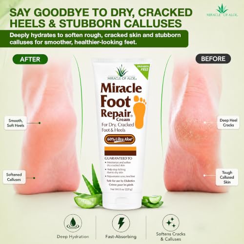 Miracle of Aloe UltraAloe Foot Cream 9 oz Pack of 2 with Hand Repair