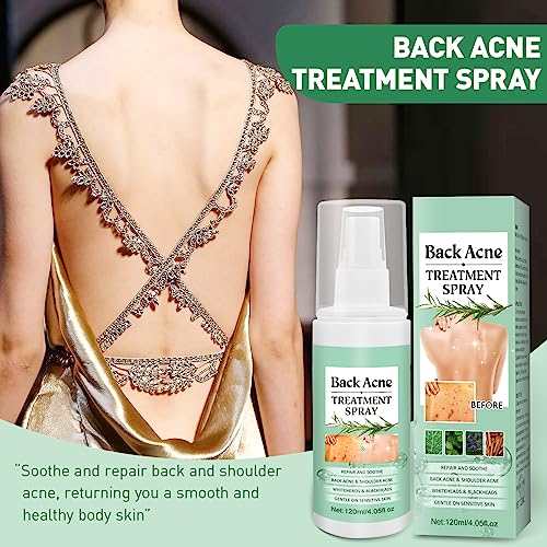 BEFIVECOK 2PCS Back Acne Spray Treatment with Herbal Formula, Salicylic Acid & Tea Tree Oil