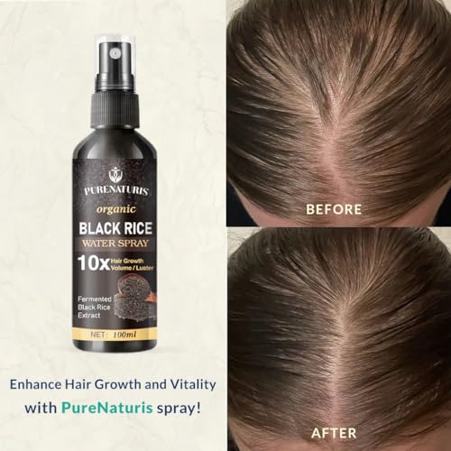 PureNaturis Castor Oil Ginger Rice Water Hair Growth Serum - Leave-In Spray for Thicker, Fuller Hair - 3.5 fl oz