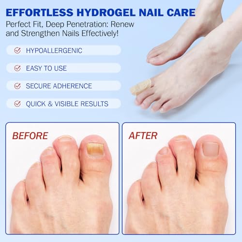 Toenail Care Patches for Discolored Nails, 21 Count Self-Adhesive Strips