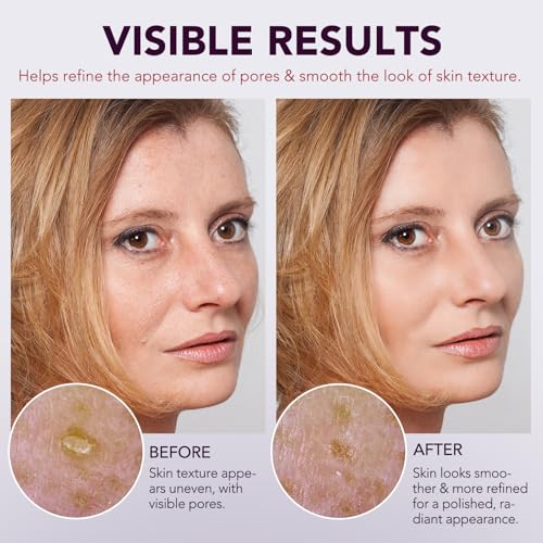 Peel Shot Glow Rice Ampoule Duo | Black Exfoliant Face and Pore