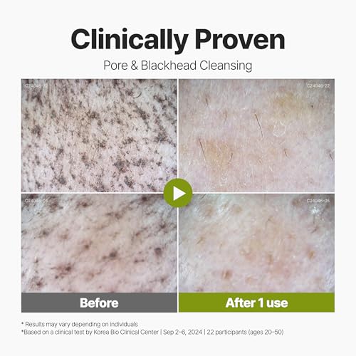 P.CALM Holy Basil Bubble Deep Mask 90g - Green | Blackhead & Pore Cleansing