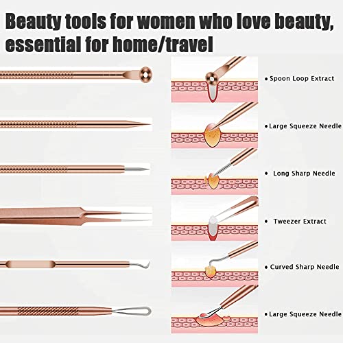 BLAAROOM Rose Gold 6-Piece Pimple Extractor Kit - Blackhead & Acne Removal Tools