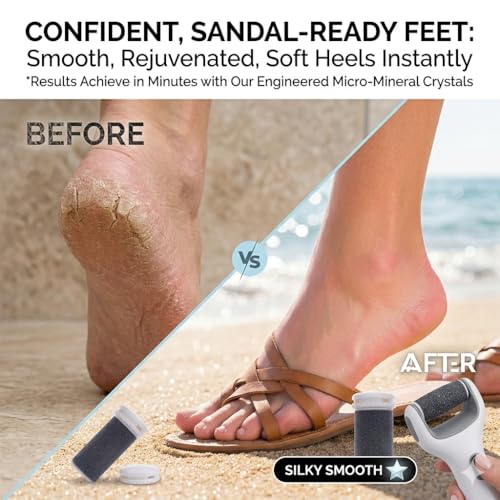 8 Pcs Extra Coarse Foot Callus Remover Refills for Electronic Foot Files