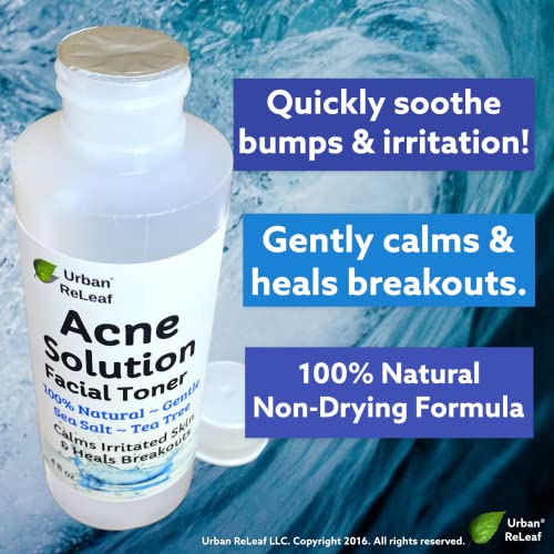 Urban ReLeaf Acne Solution Facial Toner, 4 Fl Oz - Soothe Breakouts & Reduce Pores