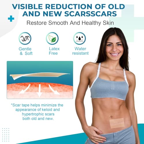 Rvlaim 3M Medical-Grade Silicone Scar Tape 1.6”x120” Reusable Sheets