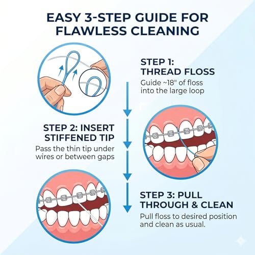 VINSULLA Orthodontic Floss Threaders Pack of 50 - Suitable for Braces, Bridges & Implants