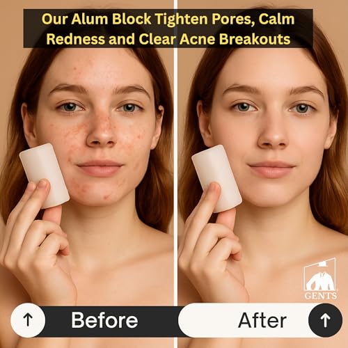 Gents Alum Block in Plastic Case | Upgrade Your Shave - Soothing Aftershave Solution for Shaving Razor Burn Relief - Travel Friendly Durable Plastic Case Included (3.5 Ounces Pack of 3)
