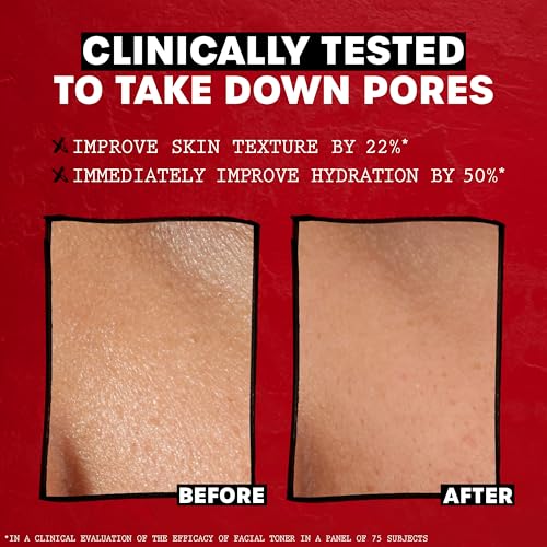 Thayers Alcohol-Free Witch Hazel Facial Mist with Aloe Vera - 8 oz