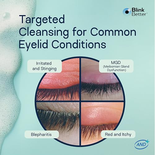 BlinkBetter Foaming Eyelid Cleanser with Tea Tree Oil – 2 fl oz