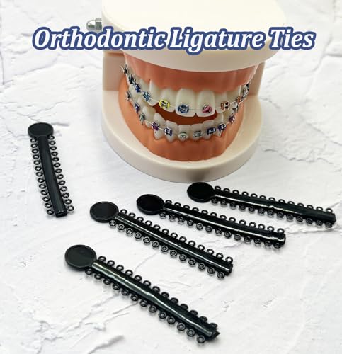 1040 Pcs Black Orthodontic Ligature Ties for Braces