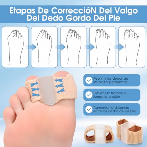 Semme Soft Toe Separators for Overlapping Toes, Bunions & Hammertoe Relief