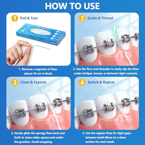 DanTicy 80-Count 3-in-1 Floss Threader for Braces, Bridges & Implants