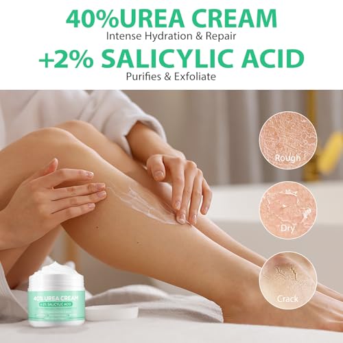 40% Urea Cream for Feet with Salicylic Acid & Aloe Vera - 5.29 OZ