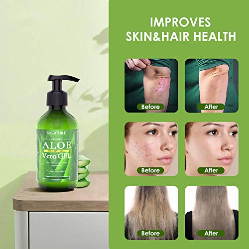 BIGHTURE Aloe Vera Gel - 100% Pure for Skin & Hair Care
