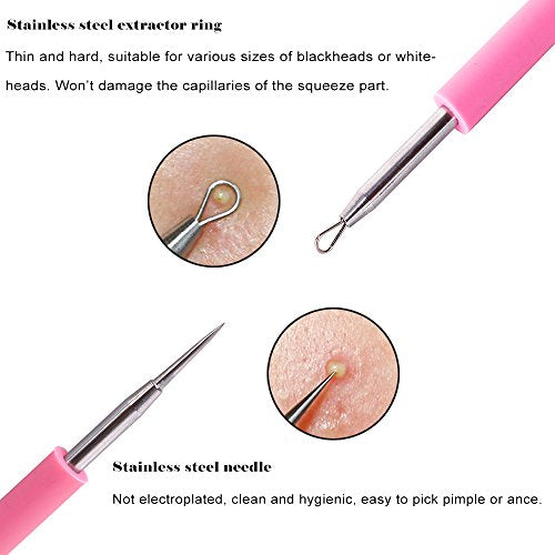 BEZOX Professional Acne Removal Tool - Blackhead & Whitehead Extractor