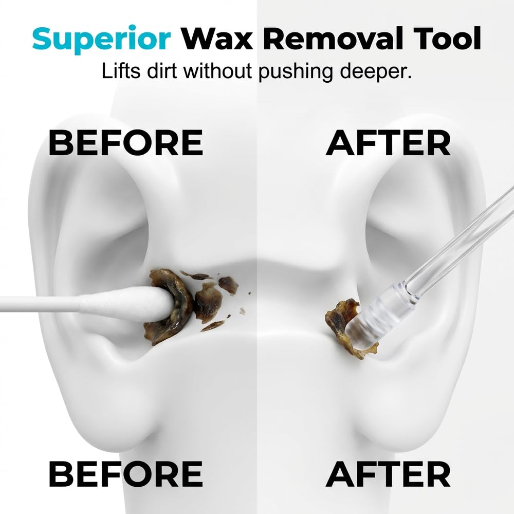 Earwax Removal Adhesive Swabs, 2026 New Reusable Sticky Ear Cleaning Stick, Ear Wax Removal Cleaning Sticks Tools with Dust Cover Packaging (Transparent*48pcs, Small)
