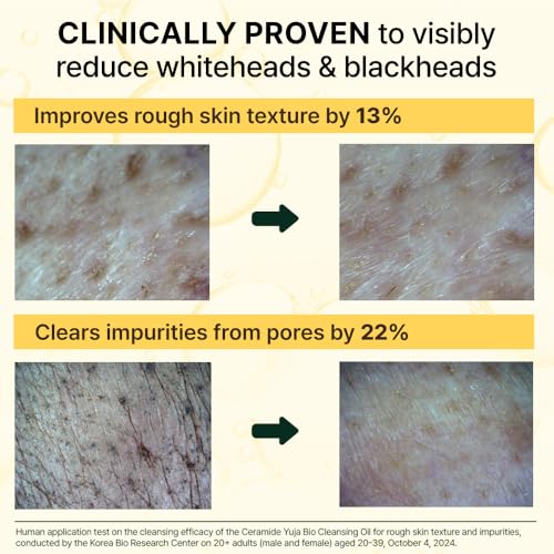 IRECIPE Ceramide Yuja Cleansing Oil – Deep Pore Makeup Remover (200ml)