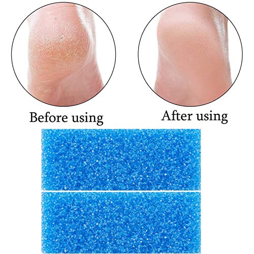 40 Pcs Pumice Stones for Feet - Callus Remover & Foot Scrubber
