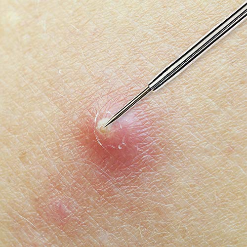 Beaute Galleria Blackhead & Acne Pimple Extractor Tool - Skin Blemish Remover