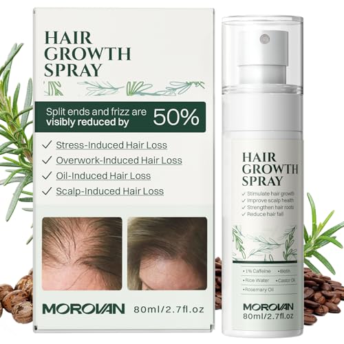 Morovan Hair Growth Spray - 30 Days to Thicker Hair with Batana & Castor Oil
