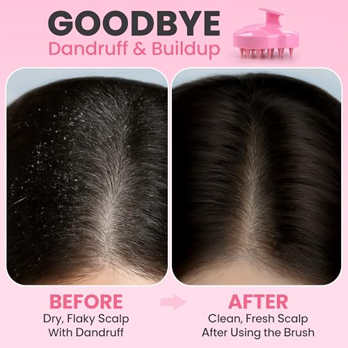 RELAXXO Pink Scalp Massager & Hair Growth Brush - Exfoliator & Shampoo Brush