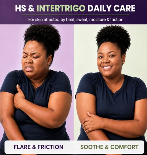 Easment HS & Intertrigo Flare Relief Balm 2oz - Skin Fold Care, Friction & Chafing