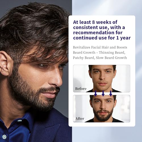Danliss 5% Minoxidil Hair & Beard Regrowth Spray - 5.42 fl oz (Pack of 2)