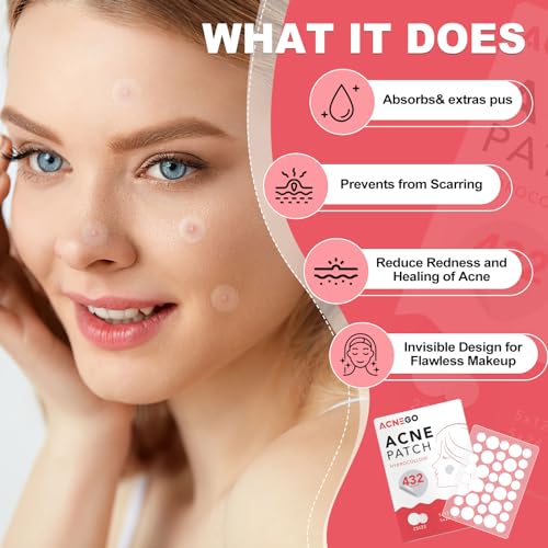 Hydrocolloid Acne Patches for Spot Treatment - 432 Count