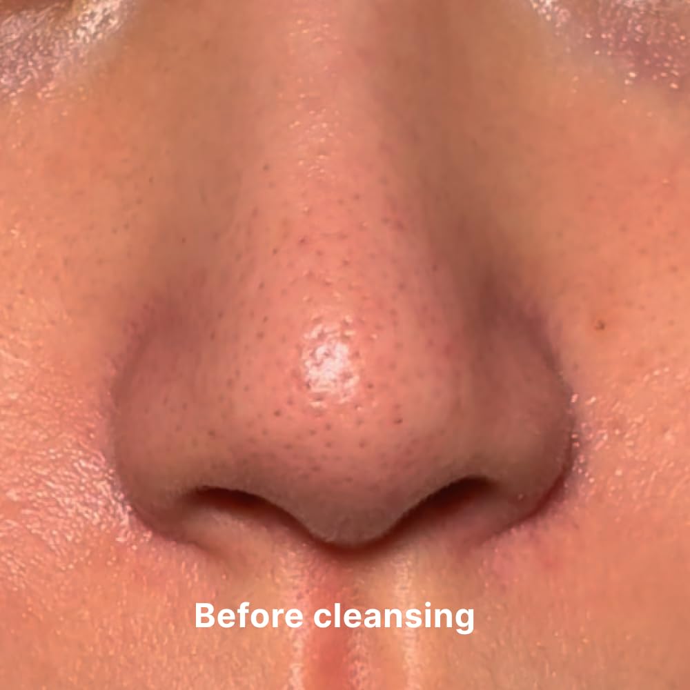 Aloe Fermentation Cleansing Oil - Hydrating Makeup Remover & Blackhead Cleanser | 6.7 fl. oz. (200ml)