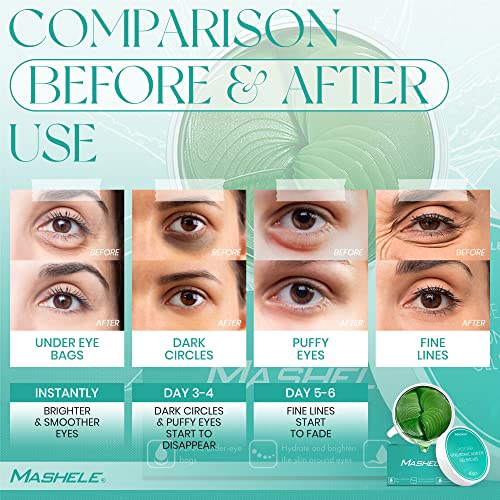 MASHELE Aloe Vera Collagen Under Eye Gel Patches - 60pcs Hydrating Treatment for Dark Circles & Puffiness