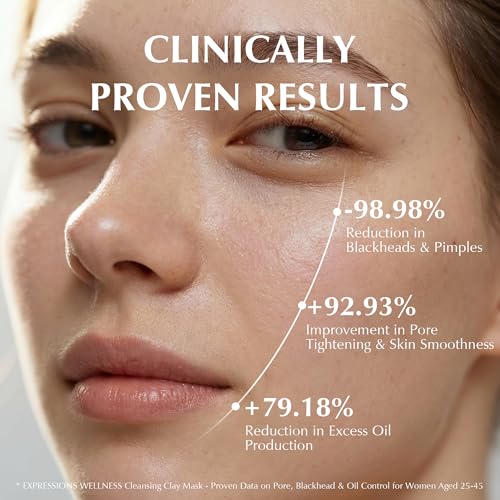 Dead Sea Clay Mask for Deep Cleansing & Acne Control - 4.06 Oz