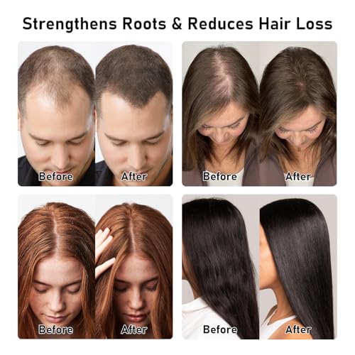 BANKIT Rosemary Batana Shampoo for Thinning Hair with Biotin & Keratin