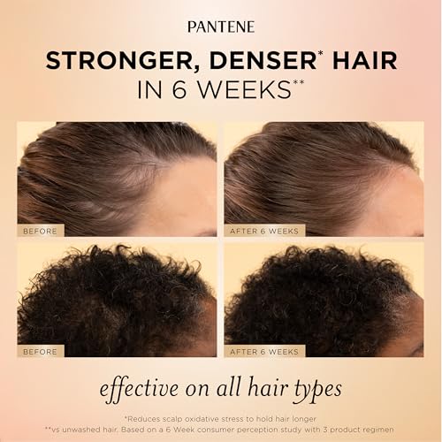 Pantene Abundant & Strong Daily Scalp & Root Serum, 2 oz