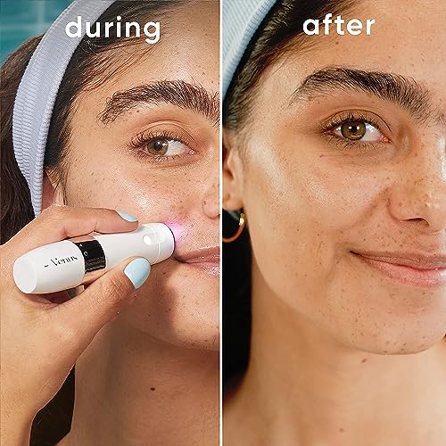 Gillette Venus Mini Facial Hair Remover for Women's Face, Portable Electric Shaver/Razor, Hair Removal for Women, Dermaplaning Tool, Trimmer